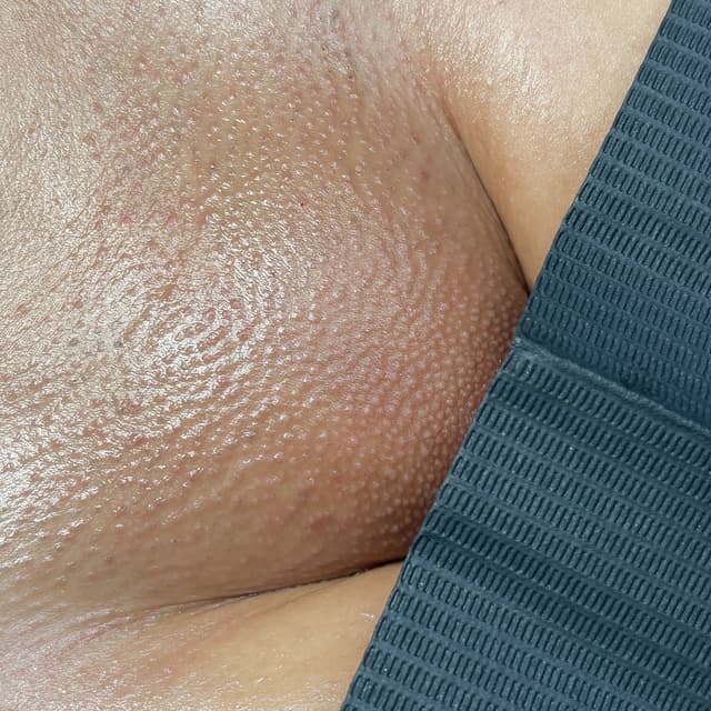 Smooth Society (6 Months) at Beauty By Yuliana in Orange, CA